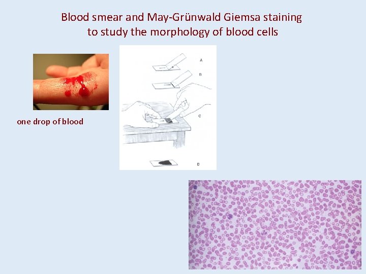 Blood smear and May-Grünwald Giemsa staining to study the morphology of blood cells one