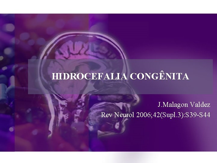 HIDROCEFALIA CONGÊNITA J. Malagon Valdez Rev Neurol 2006; 42(Supl. 3): S 39 -S 44