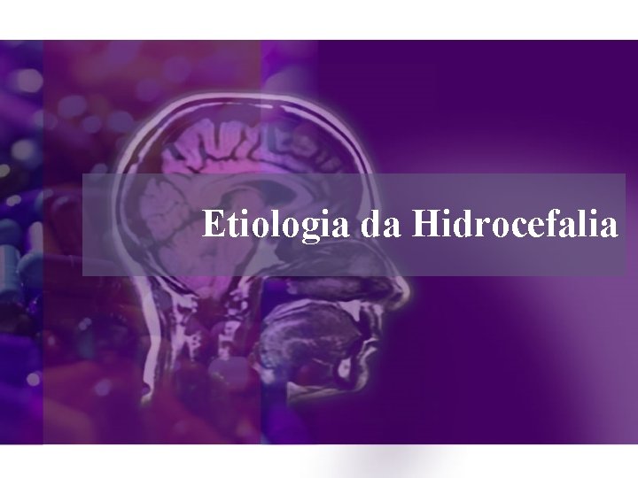 Etiologia da Hidrocefalia 