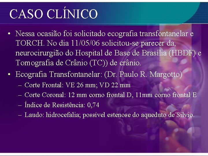 CASO CLÍNICO • Nessa ocasião foi solicitado ecografia transfontanelar e TORCH. No dia 11/05/06