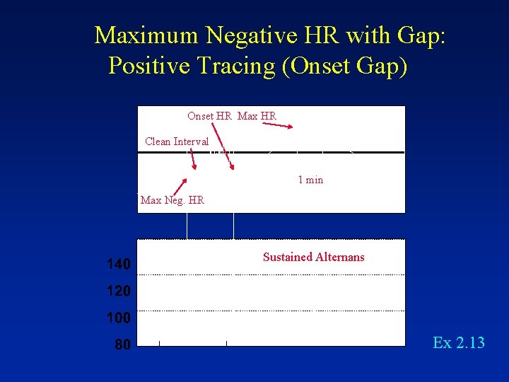 Maximum Negative HR with Gap: Positive Tracing (Onset Gap) Onset HR Max HR Clean