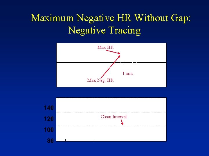 Maximum Negative HR Without Gap: Negative Tracing Max HR 1 min Max Neg. HR