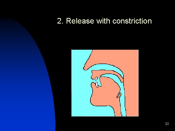 2. Release with constriction 32 
