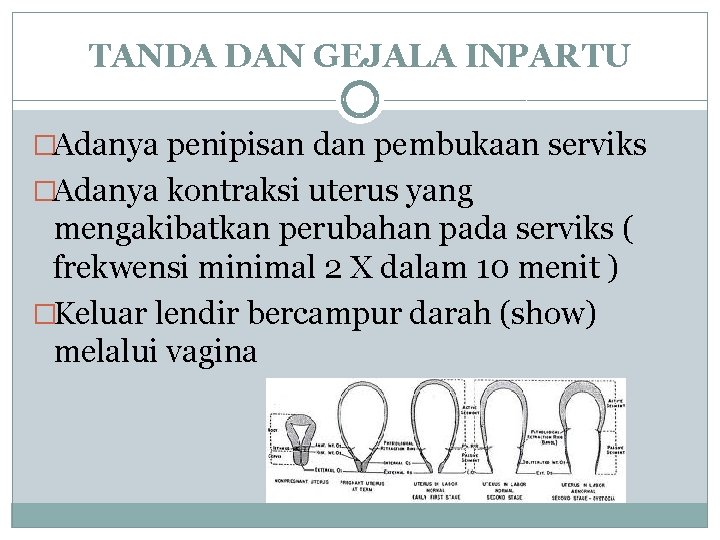 TANDA DAN GEJALA INPARTU �Adanya penipisan dan pembukaan serviks �Adanya kontraksi uterus yang mengakibatkan
