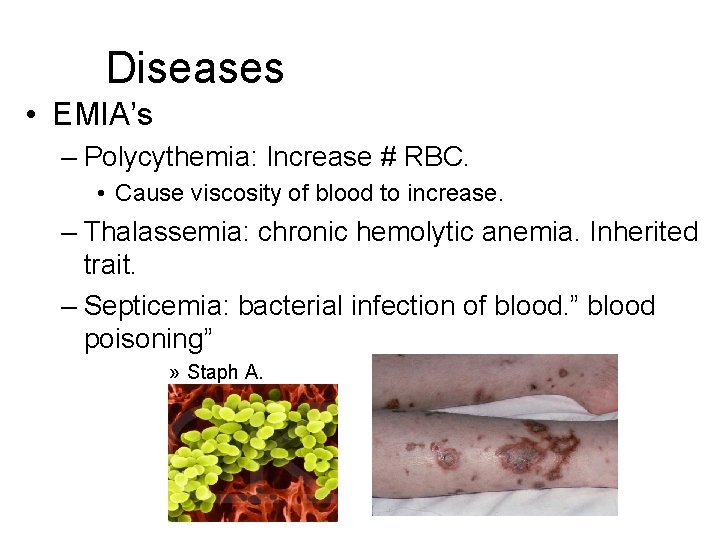 Diseases • EMIA’s – Polycythemia: Increase # RBC. • Cause viscosity of blood to