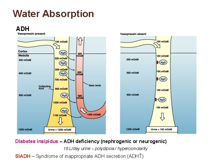 Water Absorption ADH Diabetes insipidus – ADH deficiency (nephrogenic or neurogenic) 18 L/day urine