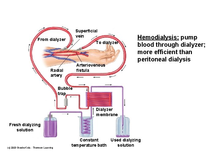 Superficial vein From dialyzer To dialyzer Hemodialysis: pump blood through dialyzer; more efficient than