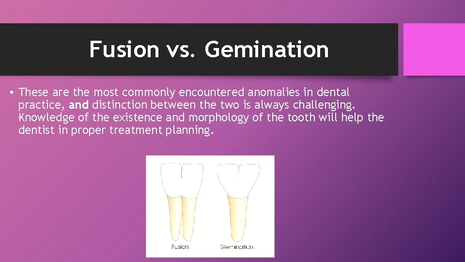 Fusion vs. Gemination • These are the most commonly encountered anomalies in dental practice,