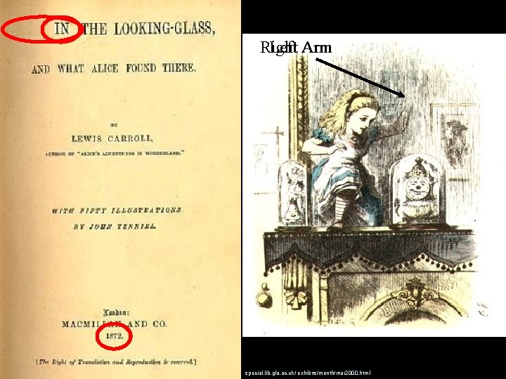 Right Left Arm special. lib. gla. ac. uk/ exhibns/month/mar 2000. html 
