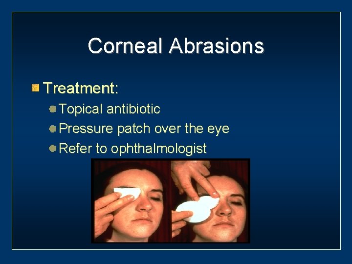 Corneal Abrasions Treatment: Topical antibiotic Pressure patch over the eye Refer to ophthalmologist 