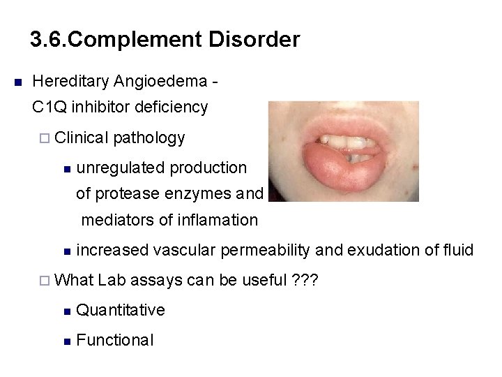 3. 6. Complement Disorder n Hereditary Angioedema C 1 Q inhibitor deficiency ¨ Clinical