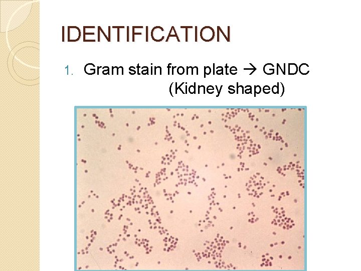 IDENTIFICATION 1. Gram stain from plate GNDC (Kidney shaped) 