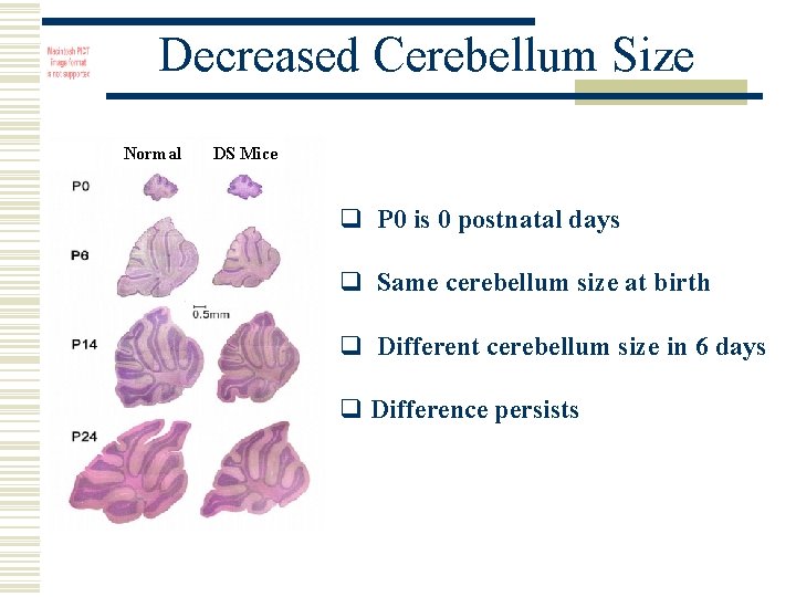 Decreased Cerebellum Size Normal DS Mice q P 0 is 0 postnatal days q