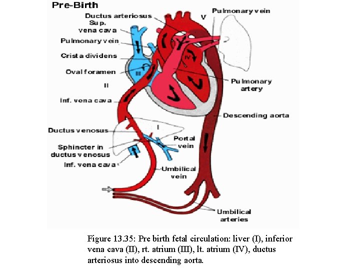 Figure 13. 35: Pre birth fetal circulation: liver (I), inferior vena cava (II), rt.