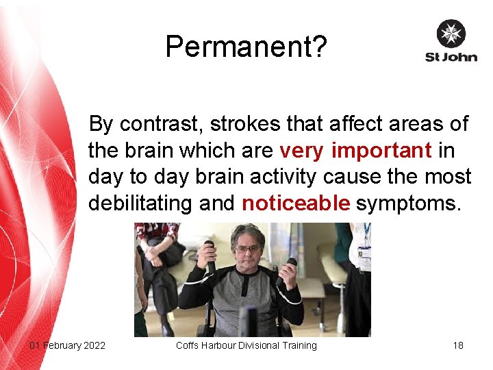 Permanent? By contrast, strokes that affect areas of the brain which are very important