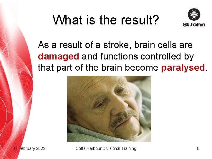 What is the result? As a result of a stroke, brain cells are damaged