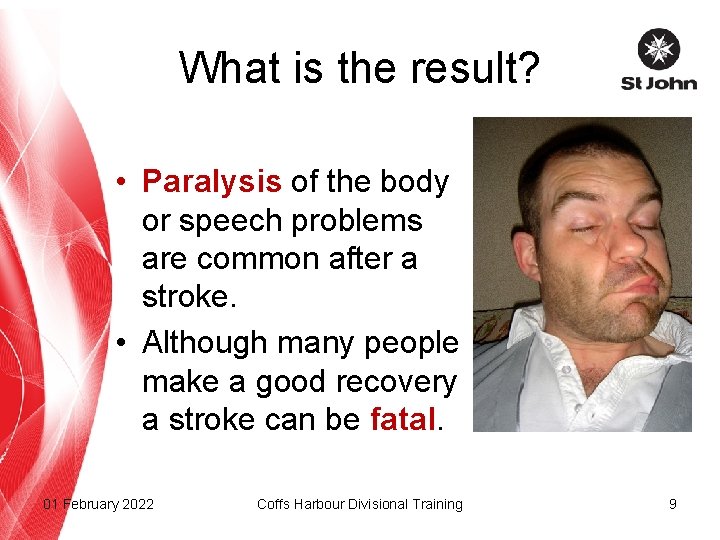 What is the result? • Paralysis of the body or speech problems are common