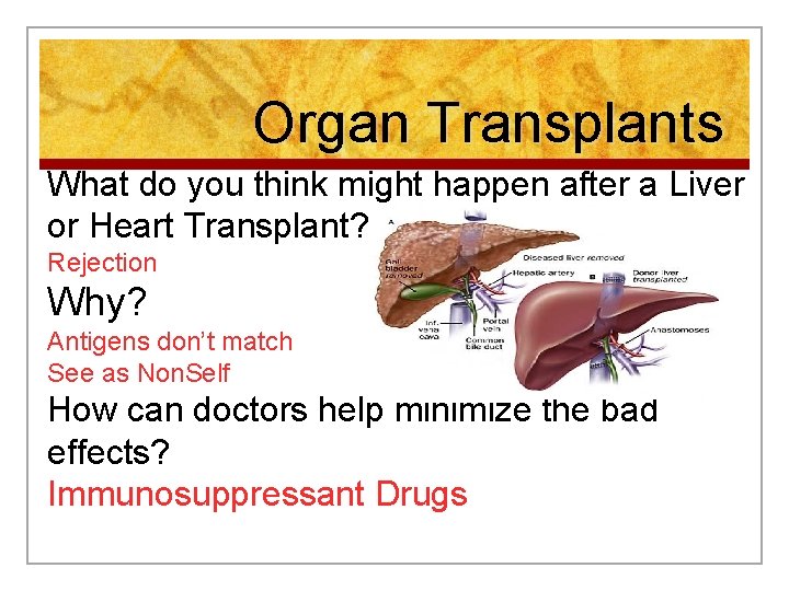 Organ Transplants What do you think might happen after a Liver or Heart Transplant?
