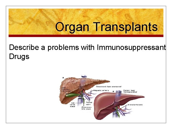 Organ Transplants Describe a problems with Immunosuppressant Drugs 