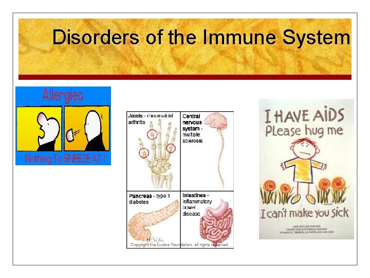 Disorders of the Immune System 