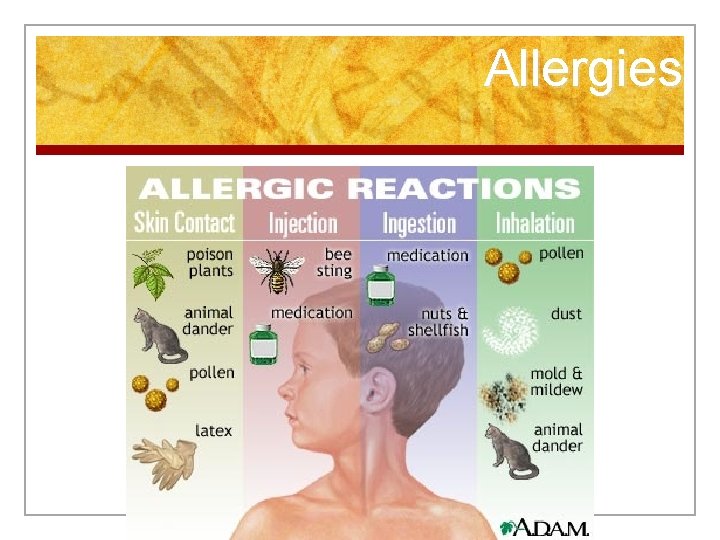 Allergies 