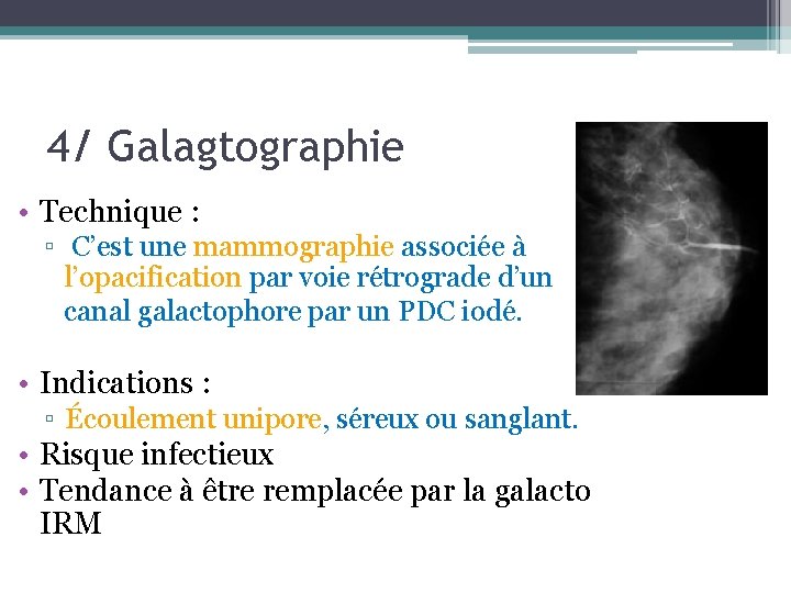 4/ Galagtographie • Technique : ▫ C’est une mammographie associée à l’opacification par voie