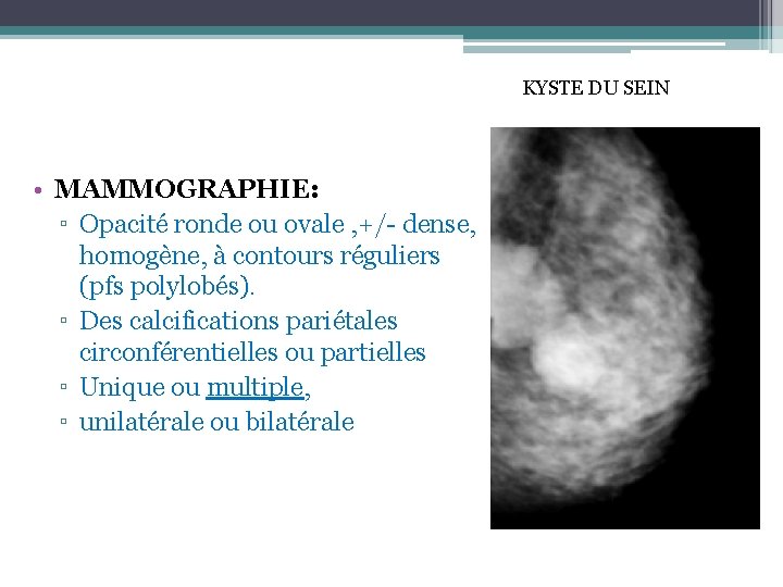 KYSTE DU SEIN • MAMMOGRAPHIE: ▫ Opacité ronde ou ovale , +/- dense, homogène,