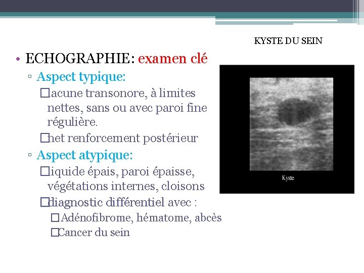 KYSTE DU SEIN • ECHOGRAPHIE: examen clé ▫ Aspect typique: �lacune transonore, à limites