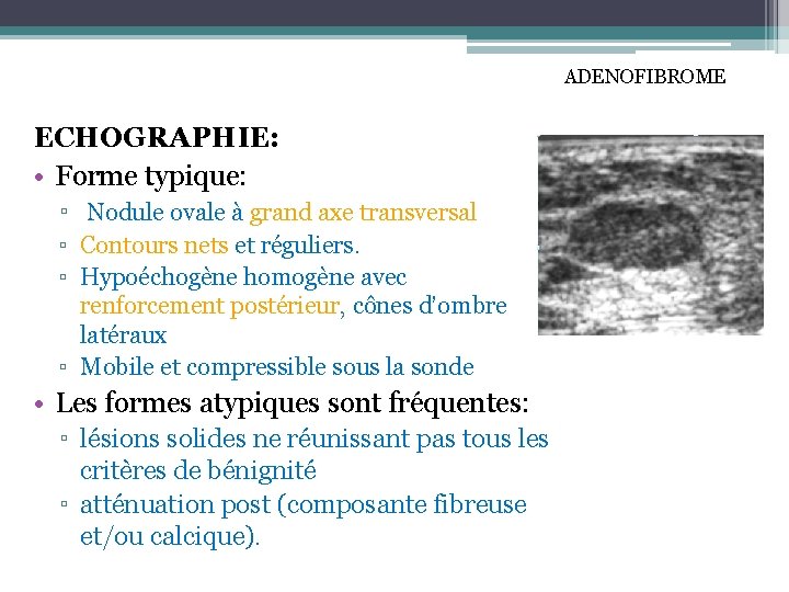 ADENOFIBROME ECHOGRAPHIE: • Forme typique: ▫ Nodule ovale à grand axe transversal ▫ Contours