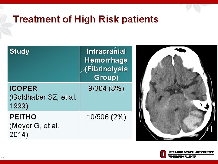 Treatment of High Risk patients Study ICOPER (Goldhaber SZ, et al. 1999) PEITHO (Meyer