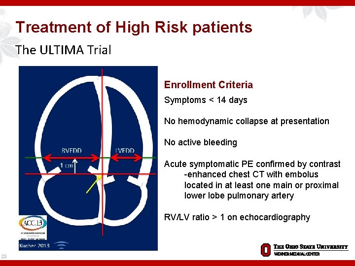 Treatment of High Risk patients The ULTIMA Trial Enrollment Criteria Symptoms < 14 days