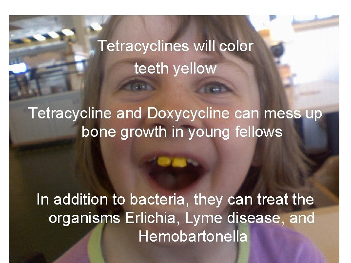 Tetracyclines will color teeth yellow Tetracycline and Doxycycline can mess up bone growth in