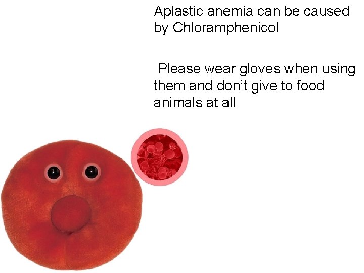 Aplastic anemia can be caused by Chloramphenicol Please wear gloves when using them and