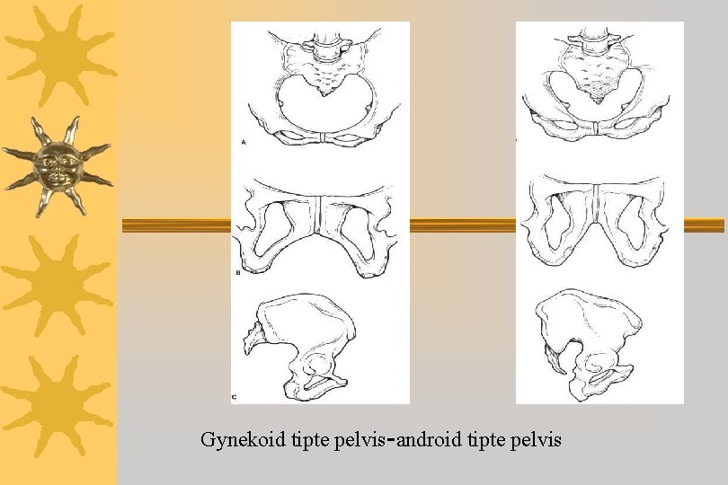 Gynekoid tipte pelvis-android tipte pelvis 