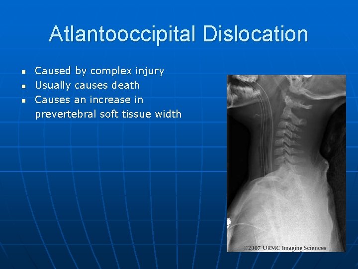 Atlantooccipital Dislocation n Caused by complex injury Usually causes death Causes an increase in
