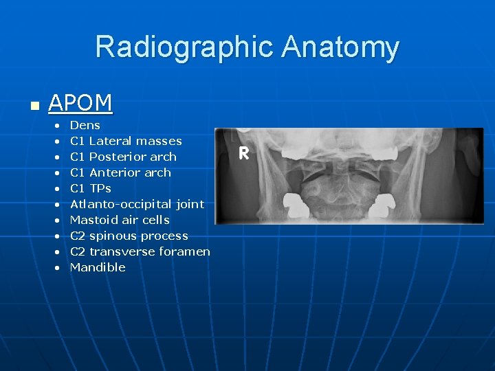 Radiographic Anatomy n APOM • • • Dens C 1 Lateral masses C 1