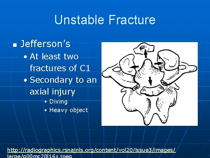 Unstable Fracture n Jefferson’s • At least two fractures of C 1 • Secondary