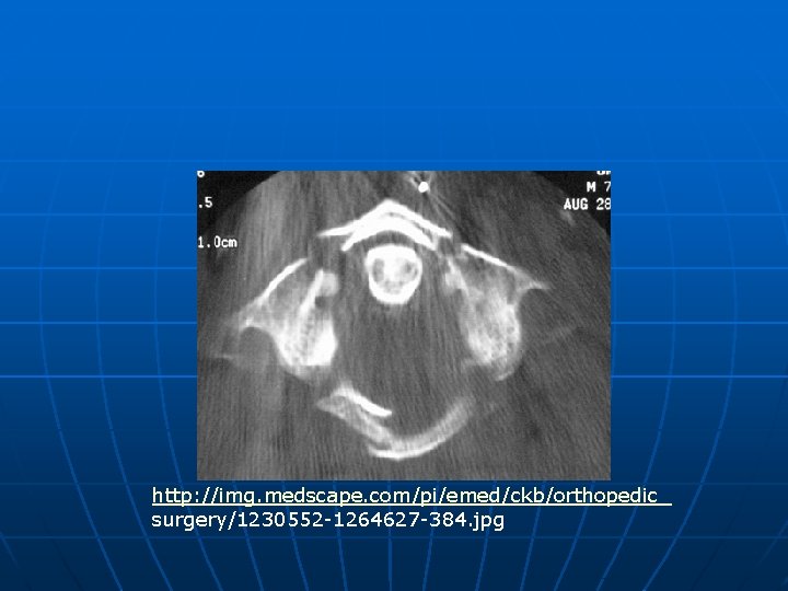 http: //img. medscape. com/pi/emed/ckb/orthopedic_ surgery/1230552 -1264627 -384. jpg 