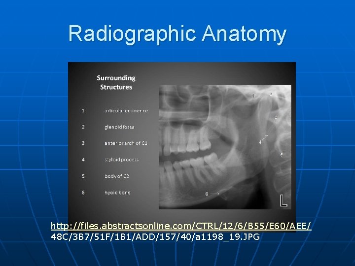 Radiographic Anatomy http: //files. abstractsonline. com/CTRL/12/6/B 55/E 60/AEE/ 48 C/3 B 7/51 F/1 B