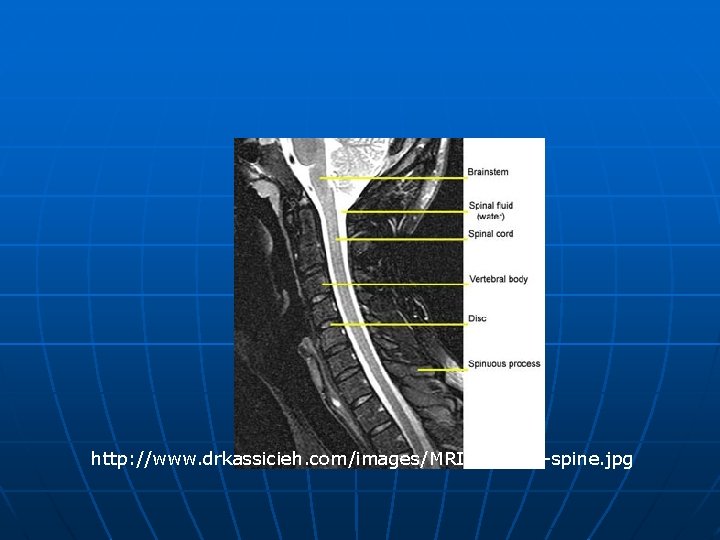 http: //www. drkassicieh. com/images/MRI-Cervical-spine. jpg 