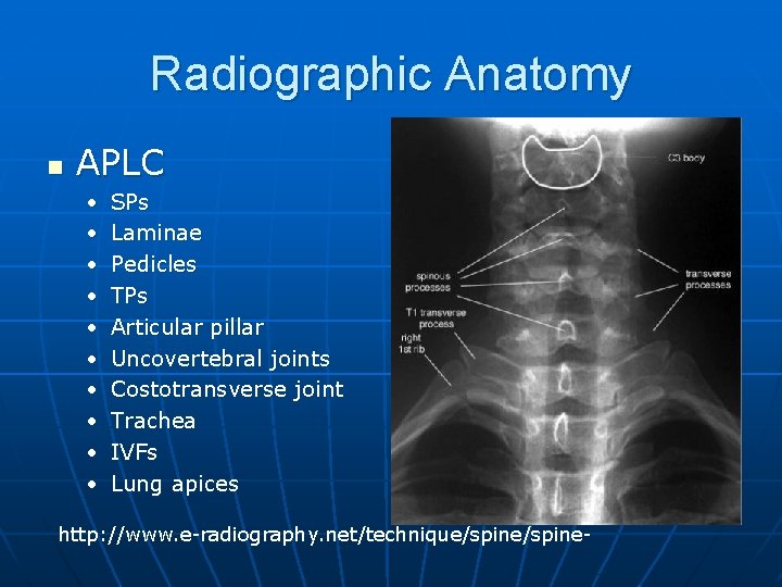 Radiographic Anatomy n APLC • • • SPs Laminae Pedicles TPs Articular pillar Uncovertebral