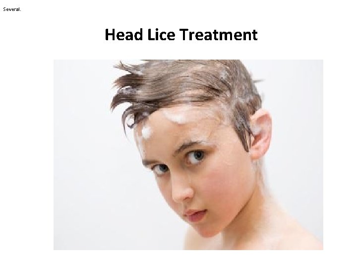 Several. Head Lice Treatment 
