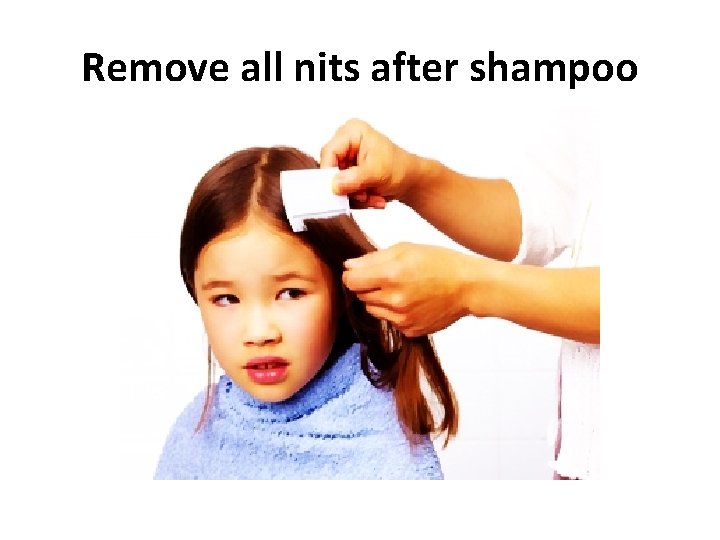 Remove all nits after shampoo 