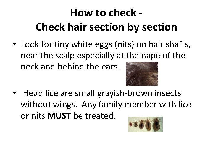 How to check Check hair section by section • Look for tiny white eggs