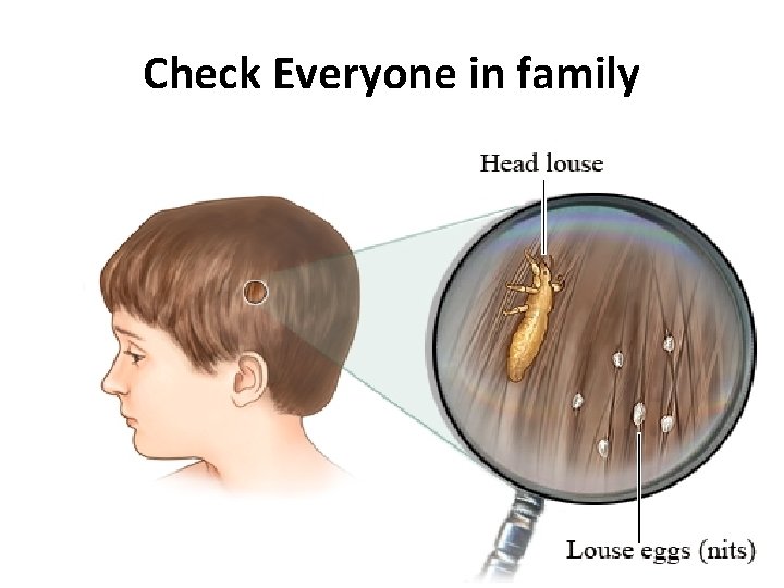 Check Everyone in family 