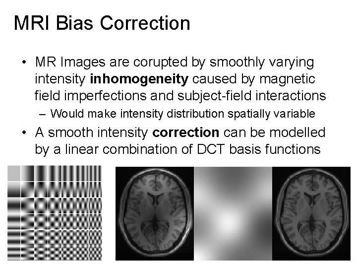 MRI Bias Correction • MR Images are corupted by smoothly varying intensity inhomogeneity caused