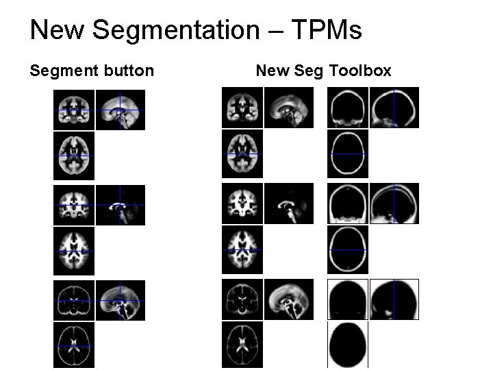 New Segmentation – TPMs Segment button New Seg Toolbox 