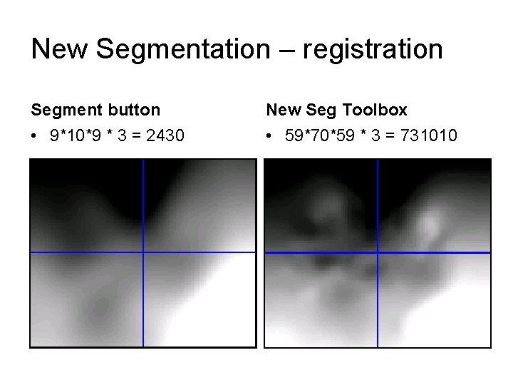 New Segmentation – registration Segment button New Seg Toolbox • 9*10*9 * 3 =