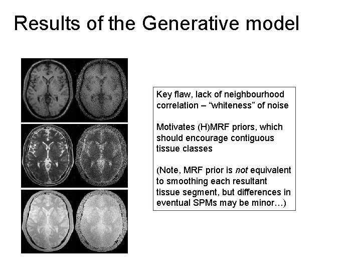 Results of the Generative model Key flaw, lack of neighbourhood correlation – “whiteness” of