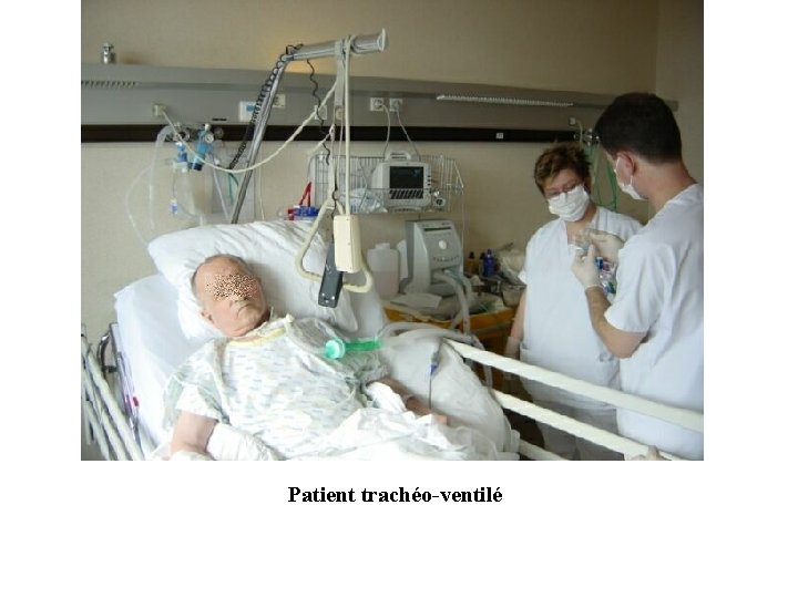 Patient trachéo-ventilé 